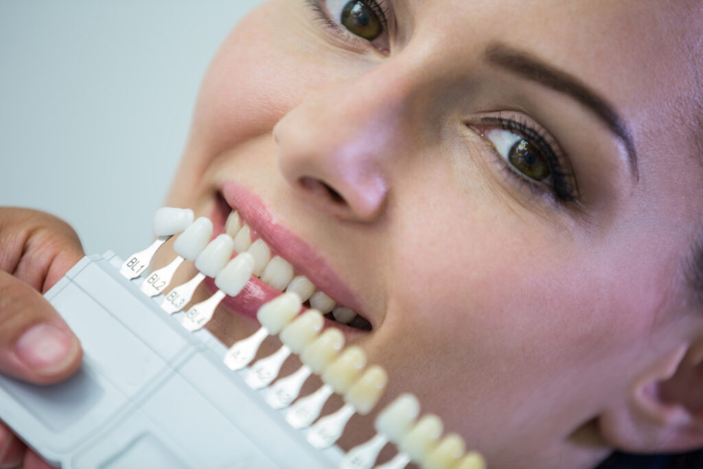 does coffee stain your teeth